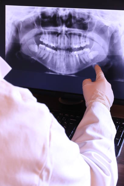 Best Emergency Root Canal Treatment in Petal, MS