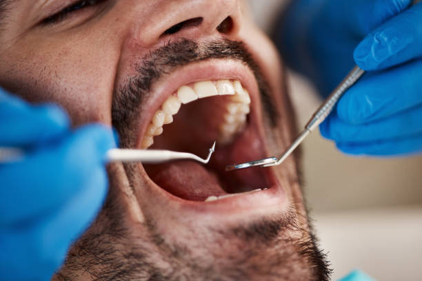 Best Emergency Dental Care for Broken or Chipped Teeth in Petal, MS